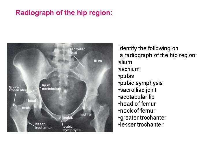 Radiograph of the hip region: Identify the following on a radiograph of the hip