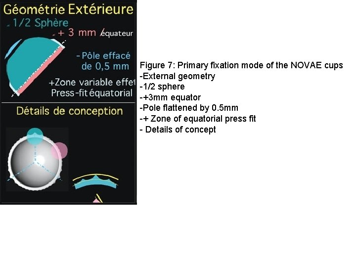 Figure 7: Primary fixation mode of the NOVAE cups External geometry 1/2 sphere +3