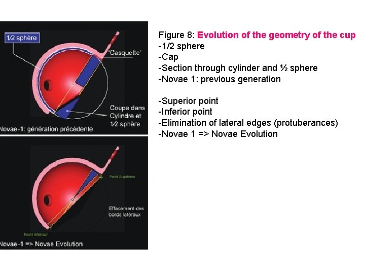 Figure 8: Evolution of the geometry of the cup 1/2 sphere Cap Section through