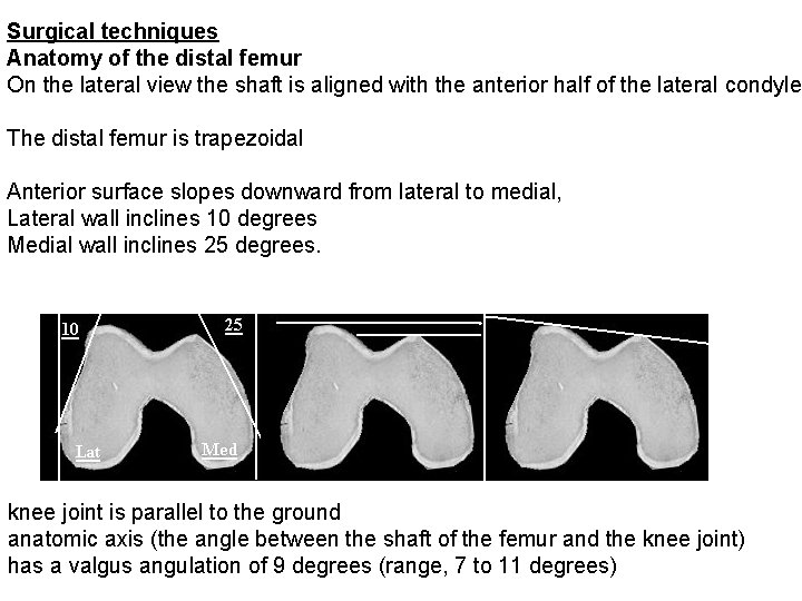 Surgical techniques Anatomy of the distal femur On the lateral view the shaft is