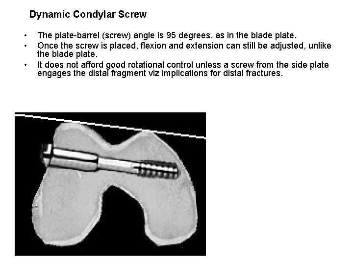 Dynamic Condylar Screw • • • The plate barrel (screw) angle is 95 degrees,