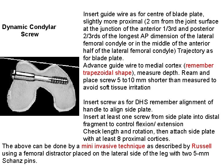  Insert guide wire as for centre of blade plate, slightly more proximal (2