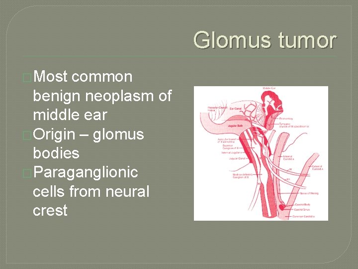 Glomus tumor �Most common benign neoplasm of middle ear �Origin – glomus bodies �Paraganglionic