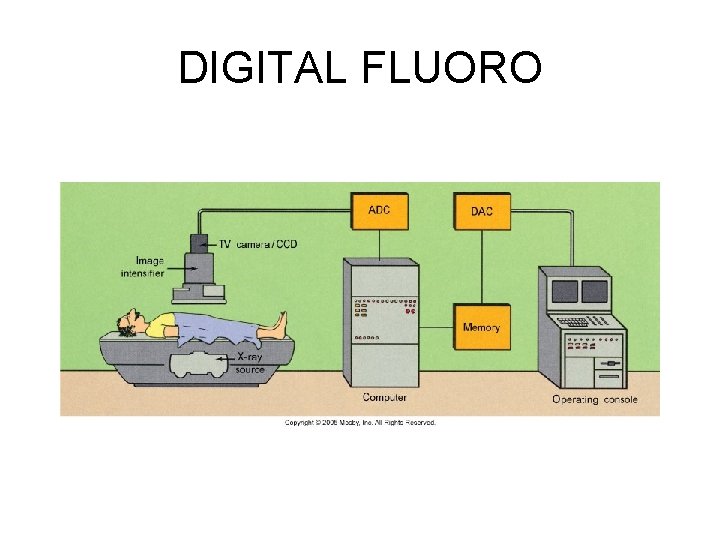 DIGITAL FLUORO DIGITAL FLUORO