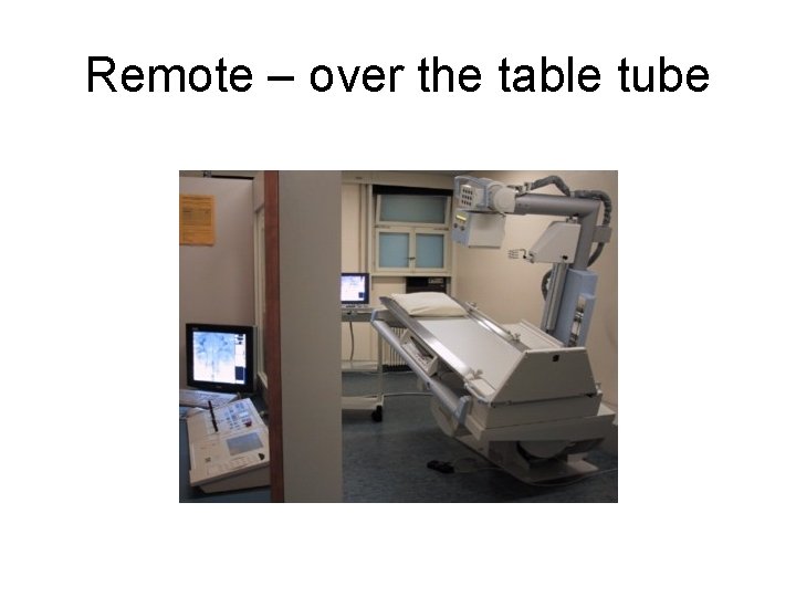 Remote – over the table tube Remote – over the table tube