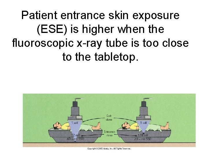 Patient entrance skin exposure (ESE) is higher when the fluoroscopic x-ray tube is too Patient entrance skin exposure (ESE) is higher when the fluoroscopic x-ray tube is too