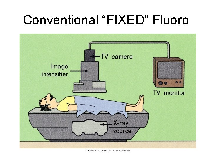Conventional “FIXED” Fluoro Conventional “FIXED” Fluoro