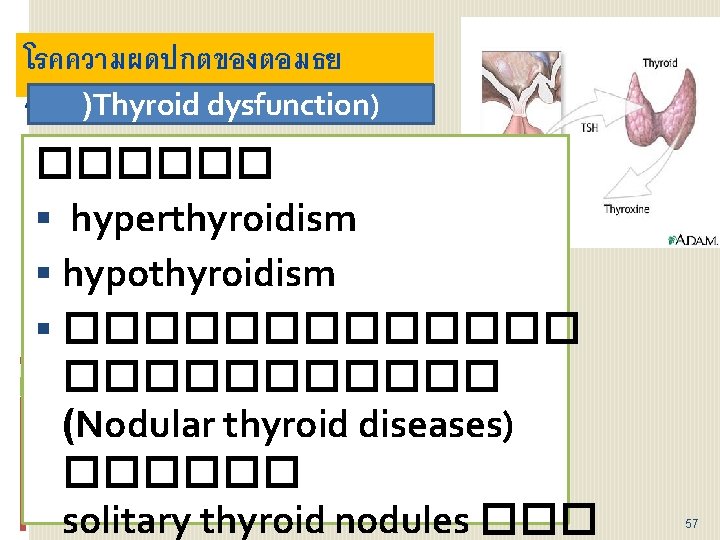 โรคความผดปกตของตอมธย รอยด)Thyroid dysfunction) ������ hyperthyroidism hypothyroidism ������� (Nodular thyroid diseases) ������ solitary thyroid nodules