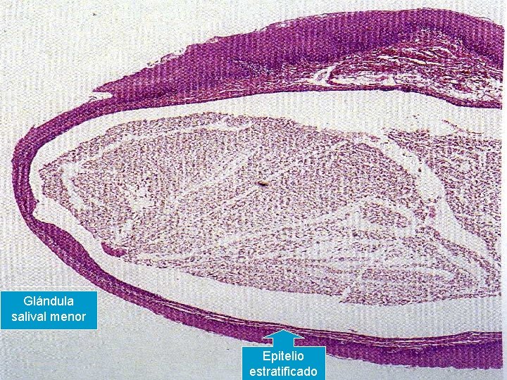 Glándula salival menor Epitelio estratificado 