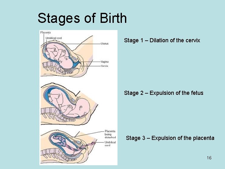 Stages of Birth Stage 1 – Dilation of the cervix Stage 2 – Expulsion