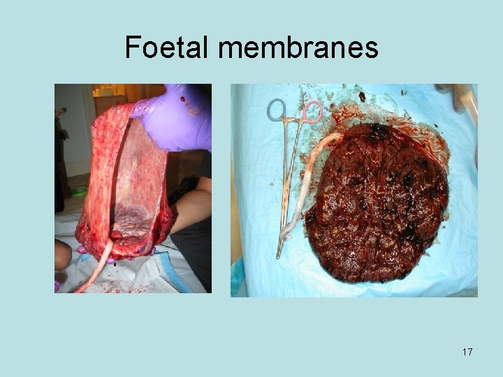 Foetal membranes 17 