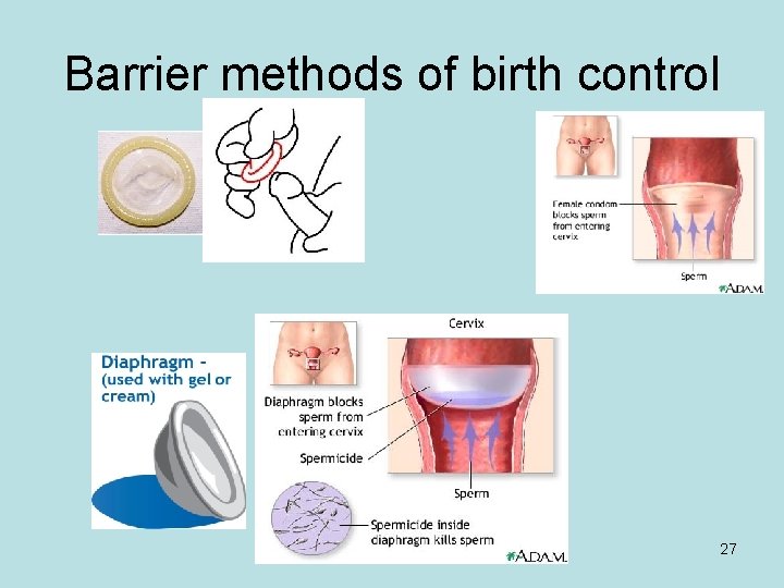 Barrier methods of birth control 27 