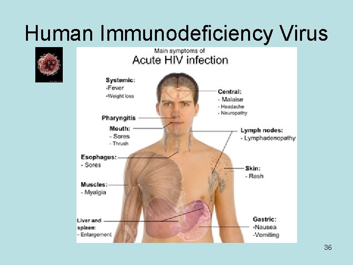 Human Immunodeficiency Virus 36 