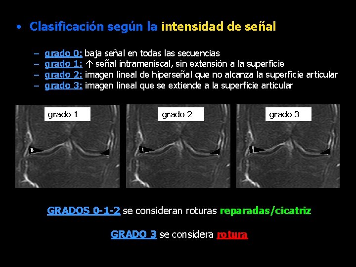  • Clasificación según la intensidad de señal – – grado 0: grado 1: