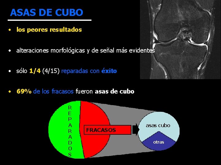 ASAS DE CUBO • los peores resultados • alteraciones morfológicas y de señal más