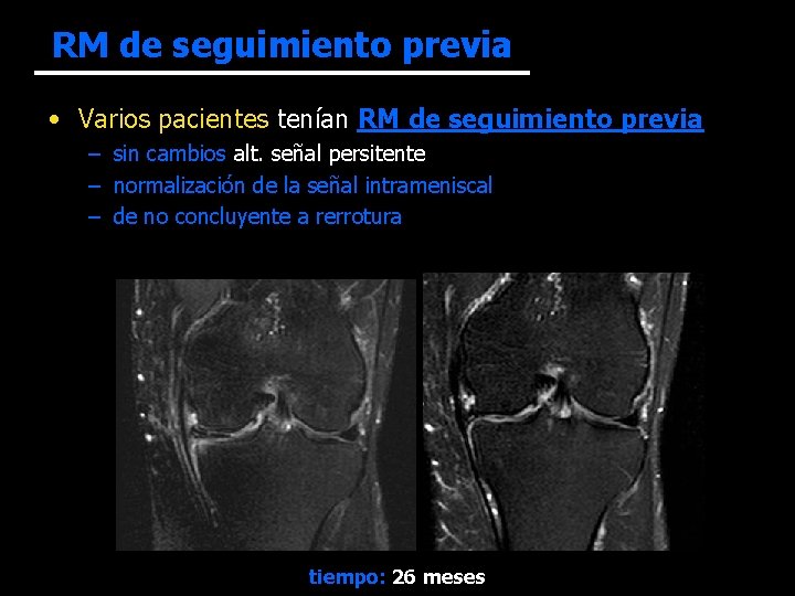 RM de seguimiento previa • Varios pacientes tenían RM de seguimiento previa – sin