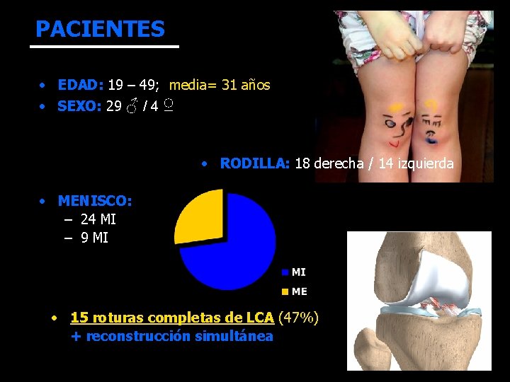 PACIENTES • EDAD: 19 – 49; media= 31 años • SEXO: 29 ♂ /