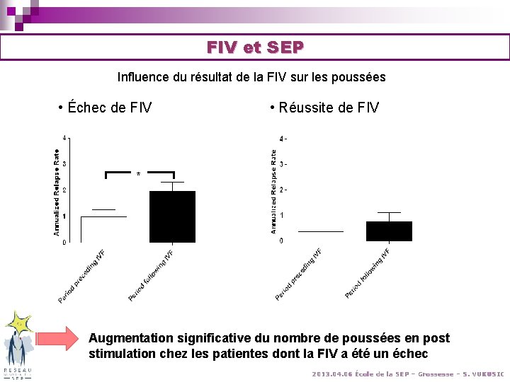FIV et SEP Influence du résultat de la FIV sur les poussées • Échec FIV et SEP Influence du résultat de la FIV sur les poussées • Échec