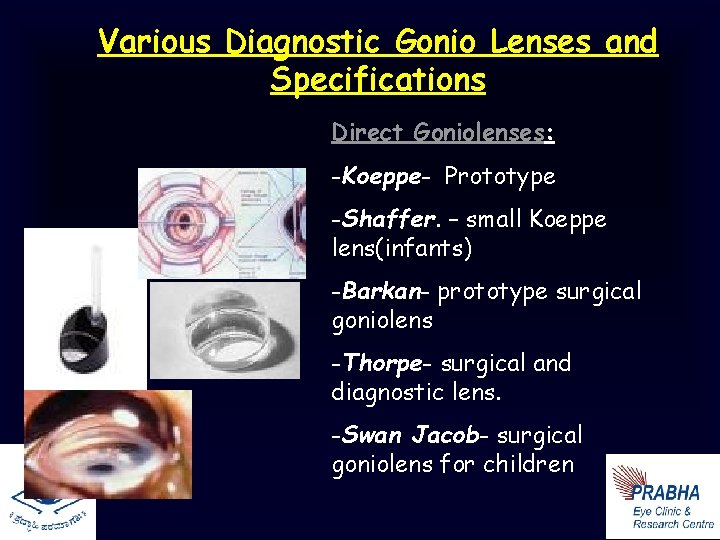 Various Diagnostic Gonio Lenses and Specifications Direct Goniolenses: -Koeppe- Prototype -Shaffer. – small Koeppe