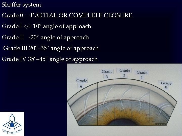 Shaffer system: Grade 0 —PARTIAL OR COMPLETE CLOSURE Grade I </= 10° angle of