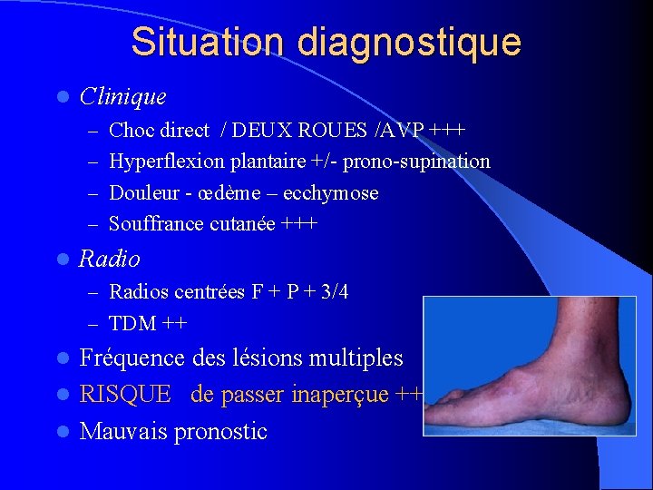 Situation diagnostique l Clinique – Choc direct / DEUX ROUES /AVP +++ – Hyperflexion