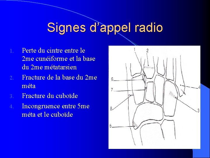 Signes d’appel radio 1. 2. 3. 4. Perte du cintre entre le 2 me