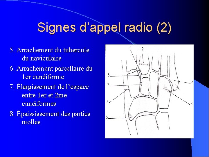 Signes d’appel radio (2) 5. Arrachement du tubercule du naviculaire 6. Arrachement parcellaire du