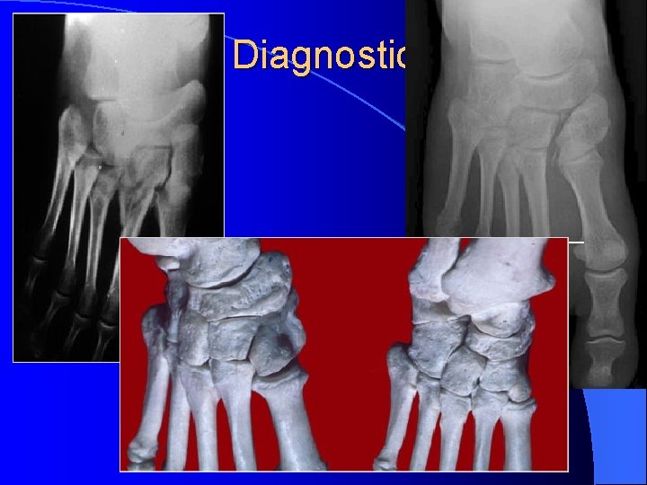 Diagnostic 