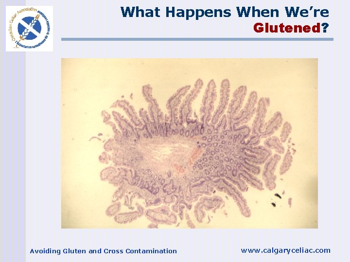 What Happens When We’re Glutened? Avoiding Gluten and Cross Contamination www. calgaryceliac. com 
