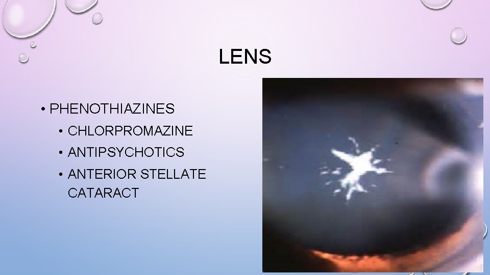 LENS • PHENOTHIAZINES • CHLORPROMAZINE • ANTIPSYCHOTICS • ANTERIOR STELLATE CATARACT 