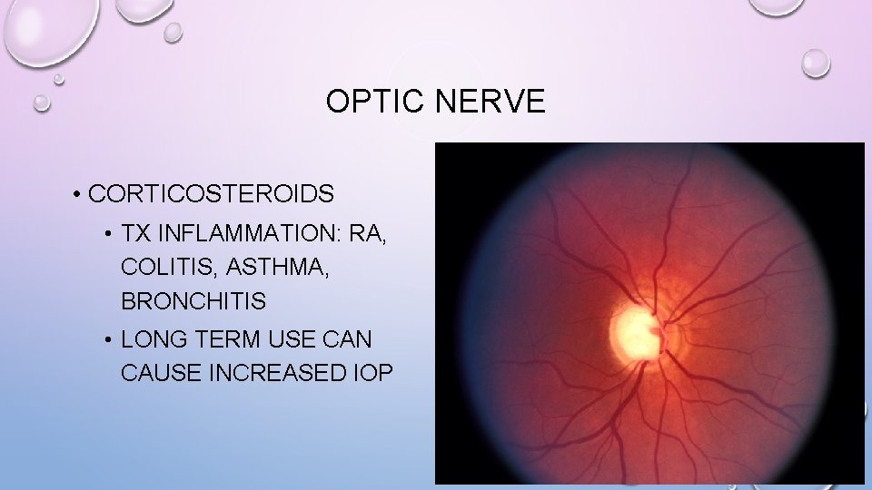 OPTIC NERVE • CORTICOSTEROIDS • TX INFLAMMATION: RA, COLITIS, ASTHMA, BRONCHITIS • LONG TERM
