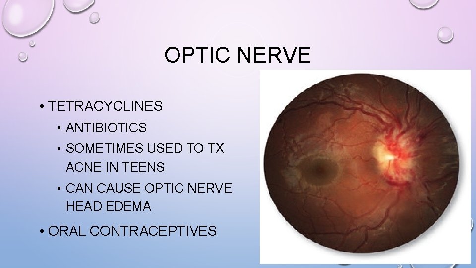 OPTIC NERVE • TETRACYCLINES • ANTIBIOTICS • SOMETIMES USED TO TX ACNE IN TEENS