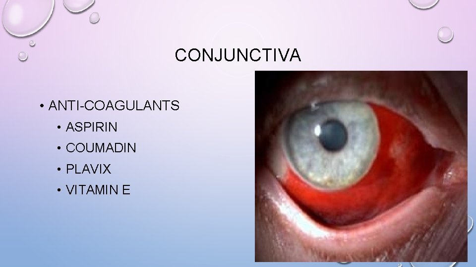 CONJUNCTIVA • ANTI-COAGULANTS • ASPIRIN • COUMADIN • PLAVIX • VITAMIN E 