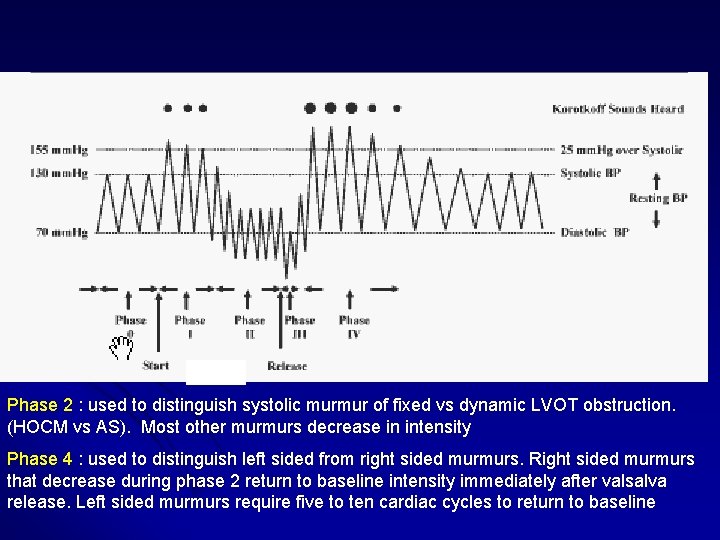 Phase 2 : used to distinguish systolic murmur of fixed vs dynamic LVOT obstruction. Phase 2 : used to distinguish systolic murmur of fixed vs dynamic LVOT obstruction.