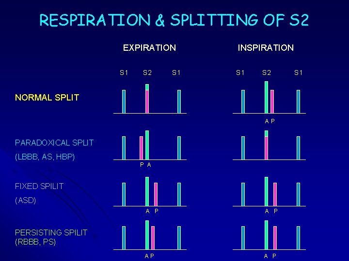 RESPIRATION & SPLITTING OF S 2 EXPIRATION S 1 S 2 S 1 INSPIRATION RESPIRATION & SPLITTING OF S 2 EXPIRATION S 1 S 2 S 1 INSPIRATION