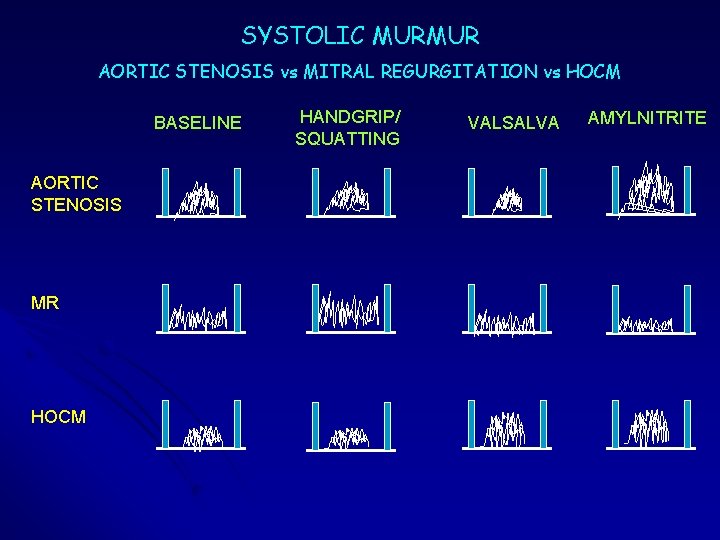 SYSTOLIC MURMUR AORTIC STENOSIS vs MITRAL REGURGITATION vs HOCM BASELINE AORTIC STENOSIS MR HOCM SYSTOLIC MURMUR AORTIC STENOSIS vs MITRAL REGURGITATION vs HOCM BASELINE AORTIC STENOSIS MR HOCM