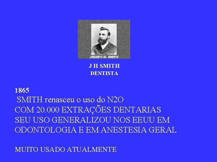 J H SMITH DENTISTA 1865 SMITH renasceu o uso do N 2 O COM