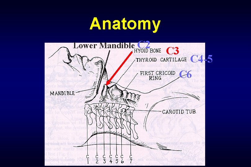 Anatomy Lower Mandible C 2 C 3 C 4 -5 C 6 