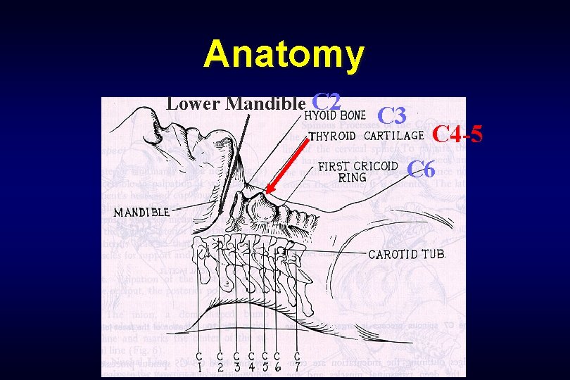 Anatomy Lower Mandible C 2 C 3 C 4 -5 C 6 