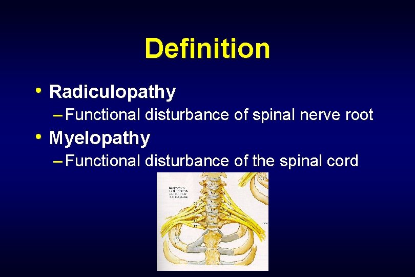 Definition • Radiculopathy – Functional disturbance of spinal nerve root • Myelopathy – Functional