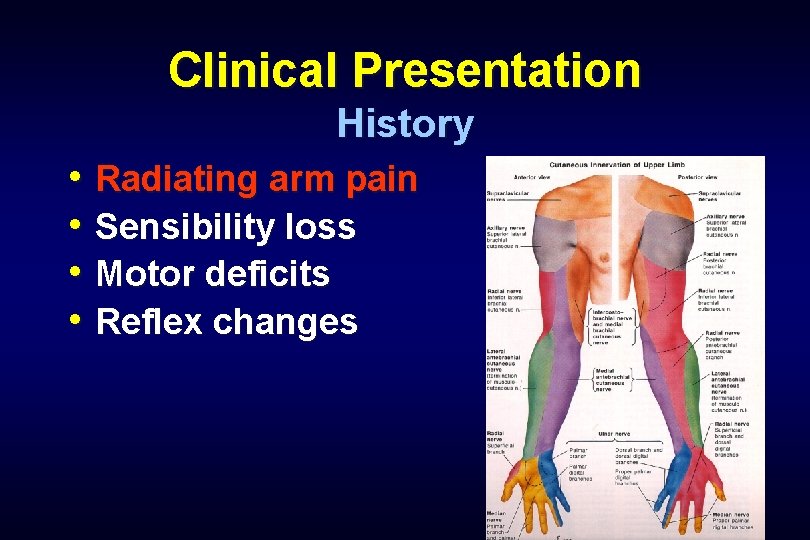 Clinical Presentation History • Radiating arm pain • Sensibility loss • Motor deficits •