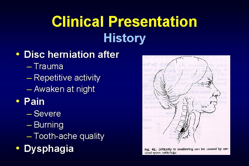 Clinical Presentation History • Disc herniation after – Trauma – Repetitive activity – Awaken