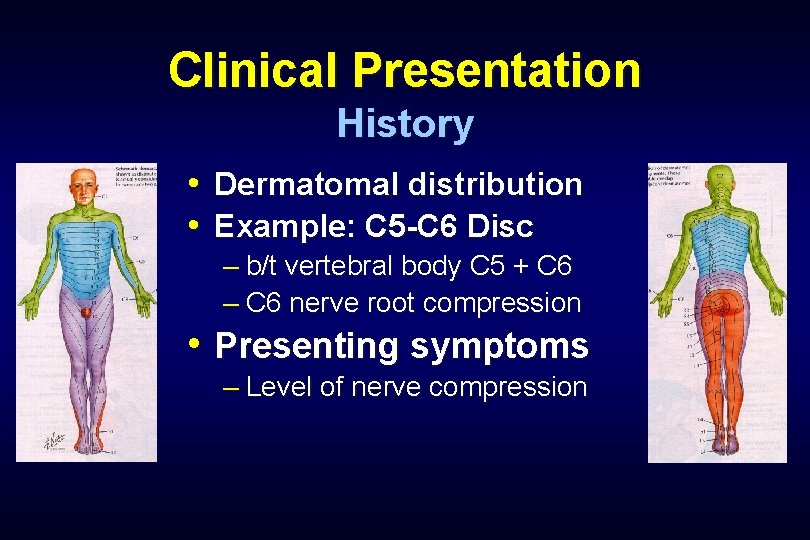 Clinical Presentation History • Dermatomal distribution • Example: C 5 -C 6 Disc –