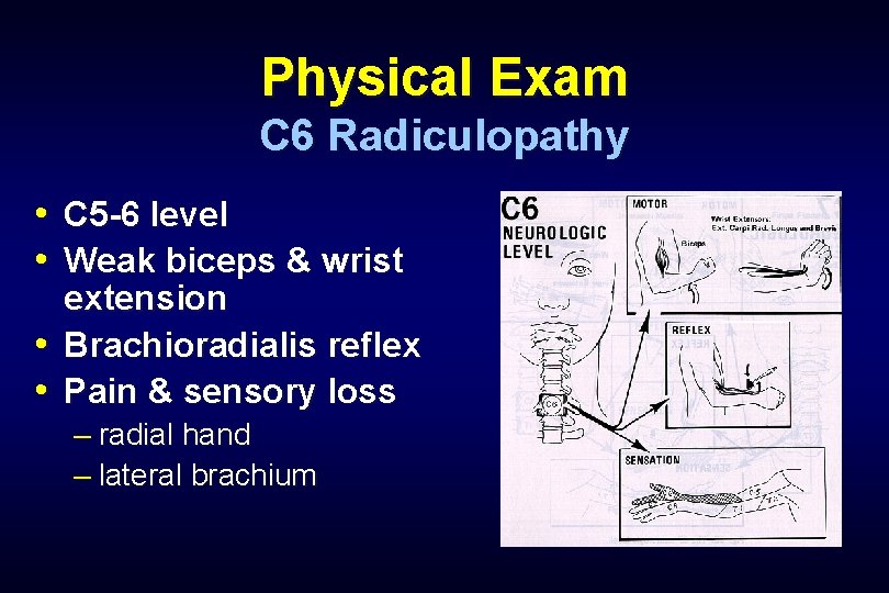 Physical Exam C 6 Radiculopathy • C 5 -6 level • Weak biceps &