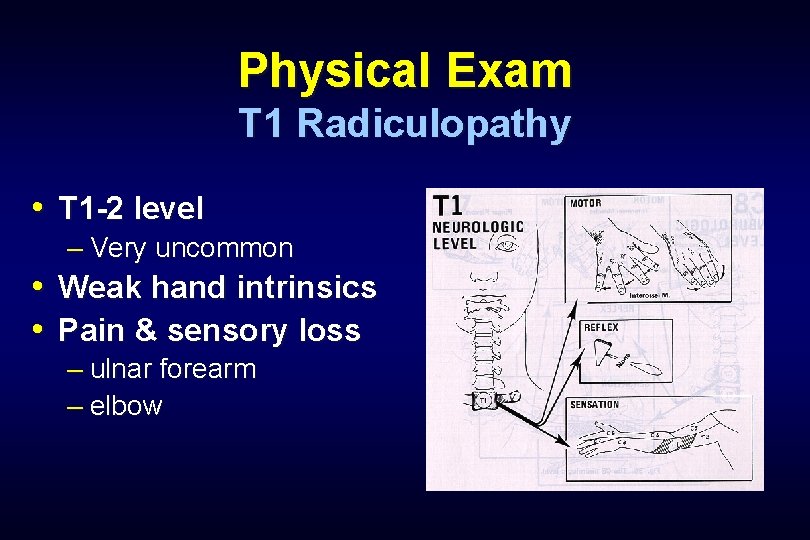 Physical Exam T 1 Radiculopathy • T 1 -2 level – Very uncommon •