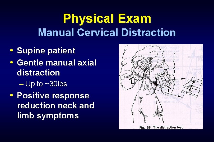 Physical Exam Manual Cervical Distraction • Supine patient • Gentle manual axial distraction –