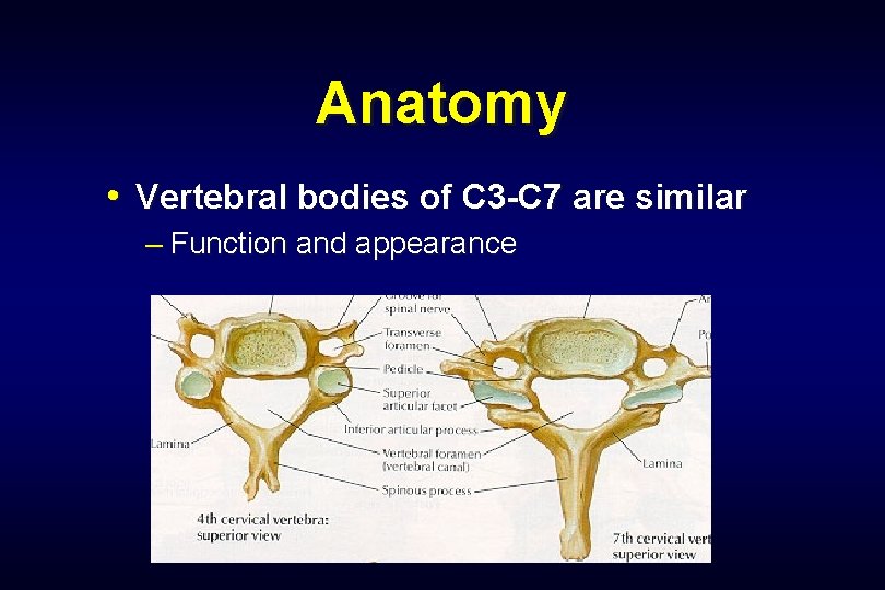 Anatomy • Vertebral bodies of C 3 -C 7 are similar – Function and