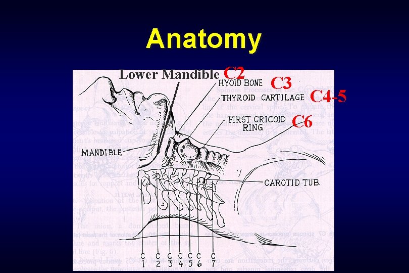 Anatomy Lower Mandible C 2 C 3 C 4 -5 C 6 