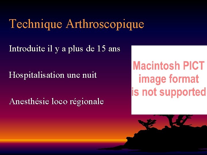 Technique Arthroscopique Introduite il y a plus de 15 ans Hospitalisation une nuit Anesthésie