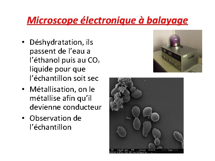 Cmeab Centre De Microscopie Electronique Applique A La